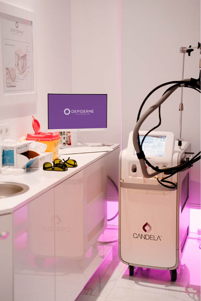 depiderme-depilacao-laser-processo2