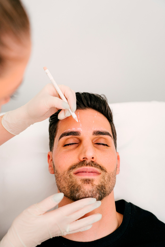 depiderme-depilacao-laser-processo4