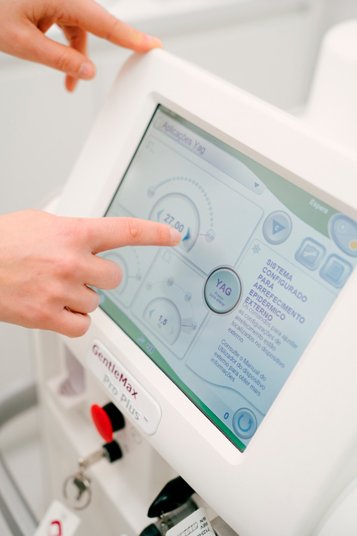 depiderme-depilacao-laser-processo5