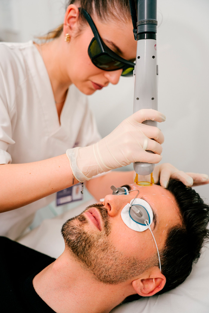 depiderme-depilacao-laser-processo7